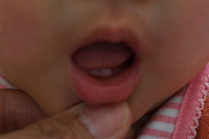 赤ちゃん 前歯